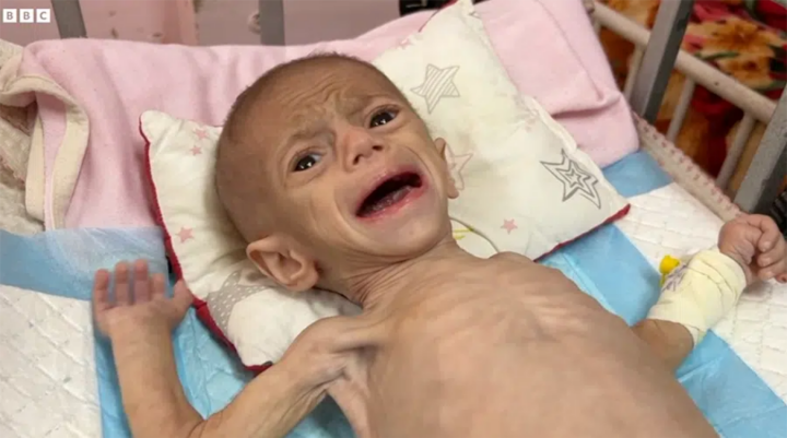 Screenshot_2025_05_29_at_12_20_54_BBC_Gaza_Baby.png.webp_WEBP_Grafik_900_501_Pixel_